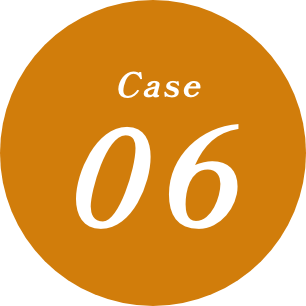 CASE06